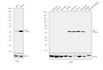 KHK Antibody in Western Blot (WB)