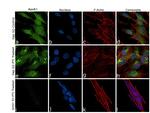 ApoA1 Antibody in Immunocytochemistry (ICC/IF)