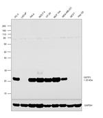 GSTP1 Antibody in Western Blot (WB)