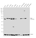 THRB Antibody in Western Blot (WB)