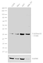 V-ATPase E1 Antibody in Western Blot (WB)