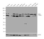 GCN5 Antibody in Western Blot (WB)