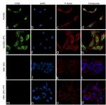 CTGF Antibody in Immunocytochemistry (ICC/IF)