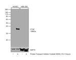 CTGF Antibody in Western Blot (WB)