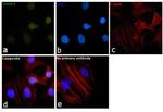 SMAD4 Antibody in Immunocytochemistry (ICC/IF)