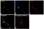 SCN8A Antibody in Immunocytochemistry (ICC/IF)