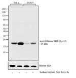 H2BK12ac Antibody