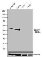 SOX11 Antibody in Western Blot (WB)