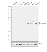 KHK Antibody in Western Blot (WB)