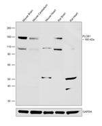 PLCB1 Antibody in Western Blot (WB)