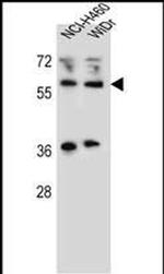 WTIP Antibody in Western Blot (WB)