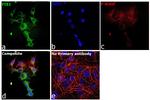 FIS1 Antibody in Immunocytochemistry (ICC/IF)