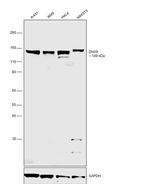 DHX9 Antibody in Western Blot (WB)