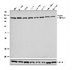 Mgea5 Antibody in Western Blot (WB)