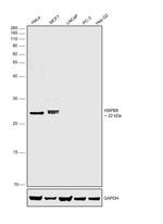 HSPB8 Antibody