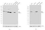 GRK2 Antibody in Western Blot (WB)