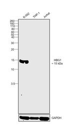 Hemoglobin gamma A Antibody