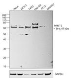 PRMT5 Antibody in Western Blot (WB)