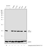 DJ-1 Antibody in Western Blot (WB)