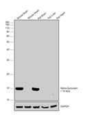 pan Synuclein Antibody in Western Blot (WB)