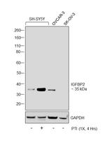 IGFBP2 Antibody