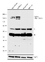 Nephrin Antibody in Western Blot (WB)