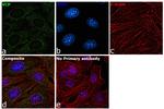 VCP Antibody in Immunocytochemistry (ICC/IF)