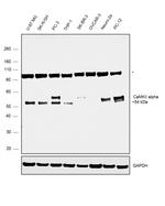 CaMKII alpha Antibody in Western Blot (WB)