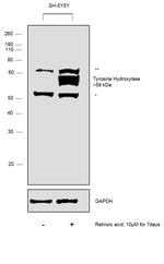 Tyrosine Hydroxylase Antibody in Western Blot (WB)