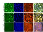 CXCL1 Antibody