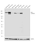 ACE Antibody in Western Blot (WB)