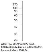 ADCY6 Antibody in Western Blot (WB)