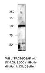 ADCY9 Antibody in Western Blot (WB)