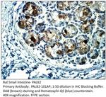 PALB2 Antibody in Immunohistochemistry (IHC)