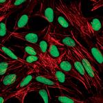 PARP1 Antibody in Immunocytochemistry (ICC/IF)