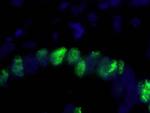 PCNA Antibody in Immunohistochemistry (IHC)