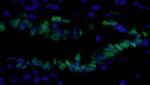 PCNA Antibody in Immunohistochemistry (IHC)