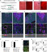 CD140a (PDGFRA) Antibody in Immunohistochemistry (IHC)