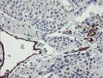 PECAM1 Antibody in Immunohistochemistry (Paraffin) (IHC (P))