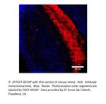 PGCF Antibody in Immunohistochemistry (IHC)