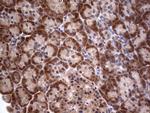 PIK3CA Antibody in Immunohistochemistry (Paraffin) (IHC (P))