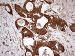 PIK3CA Antibody in Immunohistochemistry (Paraffin) (IHC (P))