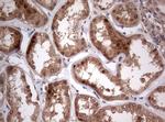 PIK3CA Antibody in Immunohistochemistry (Paraffin) (IHC (P))