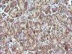 PIK3R5 Antibody in Immunohistochemistry (Paraffin) (IHC (P))