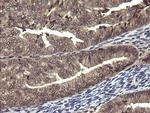 PIK3R5 Antibody in Immunohistochemistry (Paraffin) (IHC (P))