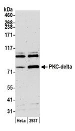 PKC-delta Antibody in Western Blot (WB)
