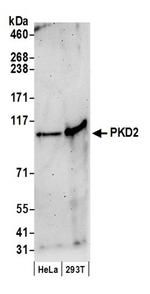 PKD2 Antibody in Western Blot (WB)