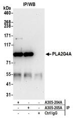 PLA2G4A/cPLA2 Antibody in Immunoprecipitation (IP)