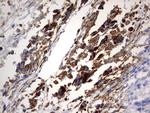 PLOD2 Antibody in Immunohistochemistry (Paraffin) (IHC (P))