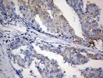 PLOD2 Antibody in Immunohistochemistry (Paraffin) (IHC (P))